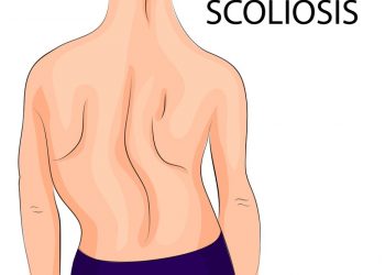 لقد نجحت طريقة علاج أورن زريف في مساعدة العديد من المرضى الذين عانوا من مشاكل في الرقبة وهيكل الجسم  تعانون من مشاكل في الرقبة وهيكل الجسم؟  لاداعي لليأس.