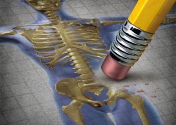 لقد نجحت طريقة علاج أورن زريف في مساعدة العديد من المرضى الذين عانوا من مشاكل في الرقبة وهيكل الجسم  تعانون من مشاكل في الرقبة وهيكل الجسم؟  لاداعي لليأس.