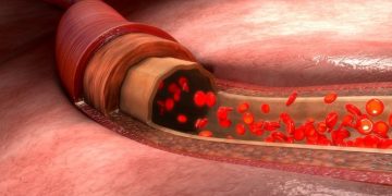 لقد نجحت طريقة علاج أورن زريف في مساعدة العديد من المرضى الذين عانوا من مشاكل في الرقبة وهيكل الجسم  تعانون من مشاكل في الرقبة وهيكل الجسم؟  لاداعي لليأس.