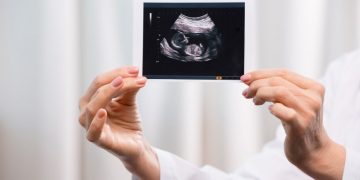 لقد نجحت طريقة علاج أورن زريف في مساعدة العديد من المرضى الذين عانوا من مشاكل في الرقبة وهيكل الجسم  تعانون من مشاكل في الرقبة وهيكل الجسم؟  لاداعي لليأس.