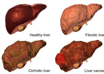 لقد نجحت طريقة علاج أورن زريف في مساعدة العديد من المرضى الذين عانوا من مشاكل في الرقبة وهيكل الجسم  تعانون من مشاكل في الرقبة وهيكل الجسم؟  لاداعي لليأس.