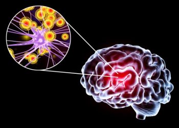 لقد نجحت طريقة علاج أورن زريف في مساعدة العديد من المرضى الذين عانوا من مشاكل في الرقبة وهيكل الجسم  تعانون من مشاكل في الرقبة وهيكل الجسم؟  لاداعي لليأس.