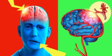 אחרי שפרופסורים הרימו ידיים – אורן זריף עשה את הבלתי יאומן והילדה החלימה משיתוק עצב הפנים