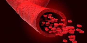 لقد نجحت طريقة علاج أورن زريف في مساعدة العديد من المرضى الذين عانوا من مشاكل في الرقبة وهيكل الجسم  تعانون من مشاكل في الرقبة وهيكل الجسم؟  لاداعي لليأس.