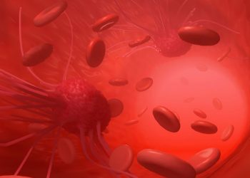 لقد نجحت طريقة علاج أورن زريف في مساعدة العديد من المرضى الذين عانوا من مشاكل في الرقبة وهيكل الجسم  تعانون من مشاكل في الرقبة وهيكل الجسم؟  لاداعي لليأس.