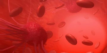 لقد نجحت طريقة علاج أورن زريف في مساعدة العديد من المرضى الذين عانوا من مشاكل في الرقبة وهيكل الجسم  تعانون من مشاكل في الرقبة وهيكل الجسم؟  لاداعي لليأس.