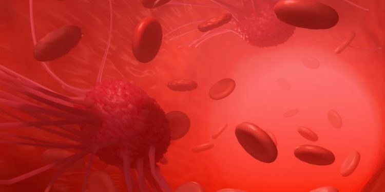 لقد نجحت طريقة علاج أورن زريف في مساعدة العديد من المرضى الذين عانوا من مشاكل في الرقبة وهيكل الجسم  تعانون من مشاكل في الرقبة وهيكل الجسم؟  لاداعي لليأس.