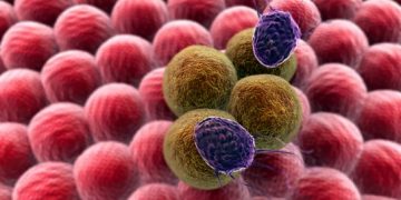 لقد نجحت طريقة علاج أورن زريف في مساعدة العديد من المرضى الذين عانوا من مشاكل في الرقبة وهيكل الجسم تعانون من مشاكل في الرقبة وهيكل الجسم؟ لاداعي لليأس.