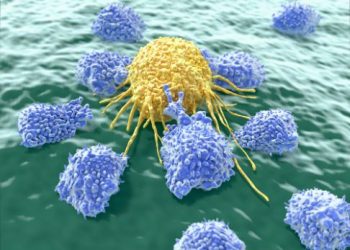 Common Lung Cancer Symptoms – Oren Zarif – Cancer