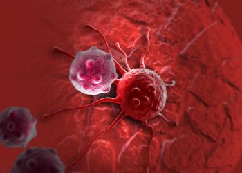 What Are Prostate Cancer Symptoms? – Oren Zarif – Cancer