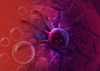 Symptoms of Lung Cancer You Should Know About – Oren Zarif – Cancer