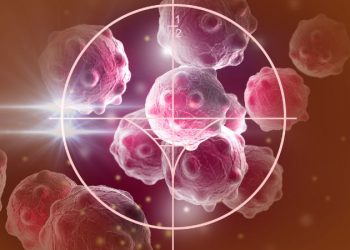 Cancer prostate symptoms can be a signal for a medical problem – Oren Zarif – Cancer