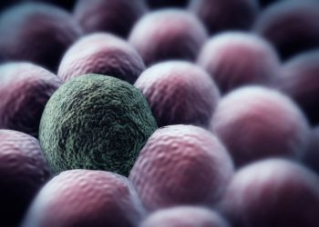 What Are Lung Cancer Symptoms? – Oren Zarif – Cancer