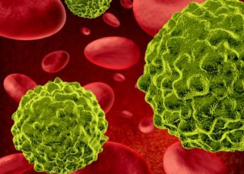 A common question that arises is, "What are thyroid symptoms?" – Oren Zarif – Cancer