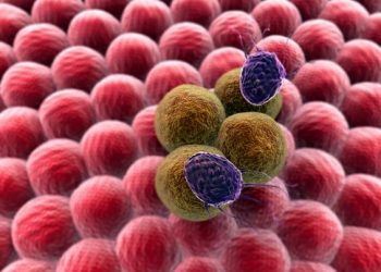 What Are Kidney Cancer Symptoms? – Oren Zarif – Cancer